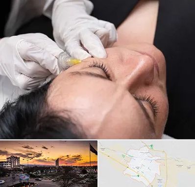 کربوکسی تراپی در قوچان