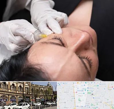 کربوکسی تراپی در منطقه 11 تهران 