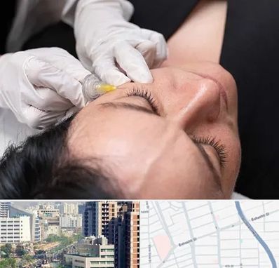کربوکسی تراپی در خیابان بهشتی