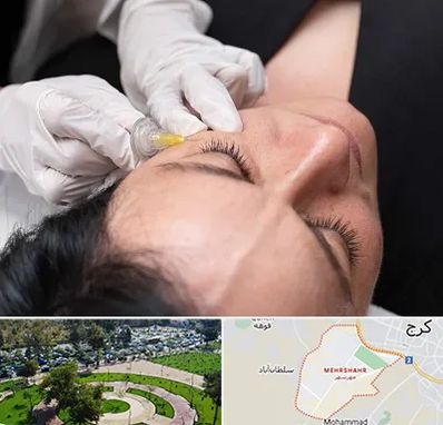 کربوکسی تراپی در مهرشهر کرج 