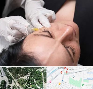 کربوکسی تراپی در سالاریه قم