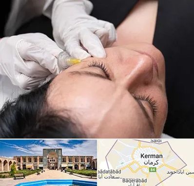 کربوکسی تراپی در کرمان