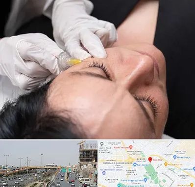 کربوکسی تراپی در بلوار توس مشهد