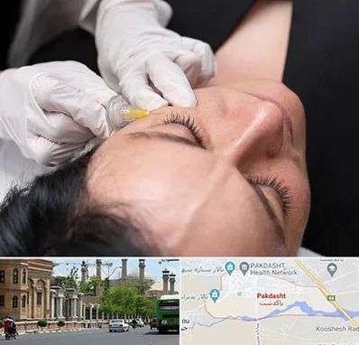 کربوکسی تراپی در پاکدشت