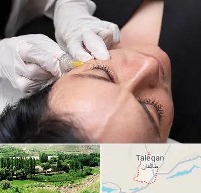 کربوکسی تراپی در طالقان
