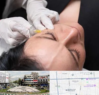 کربوکسی تراپی در مرکز تهران