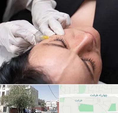 کربوکسی تراپی در طرشت