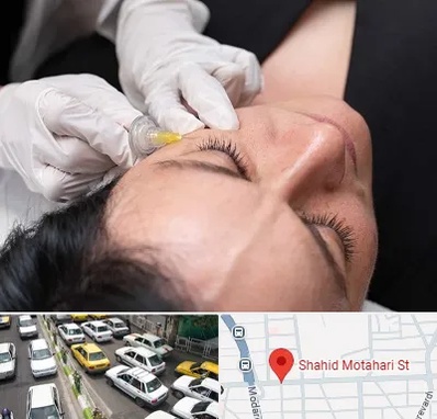کربوکسی تراپی در مطهری تهران