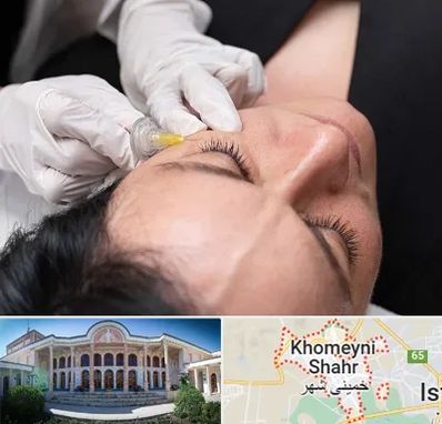 کربوکسی تراپی در خمینی شهر