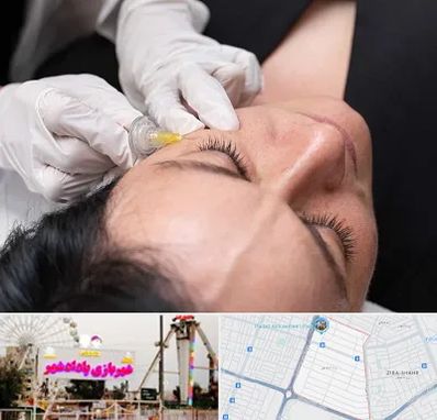 کربوکسی تراپی در پادادشهر اهواز