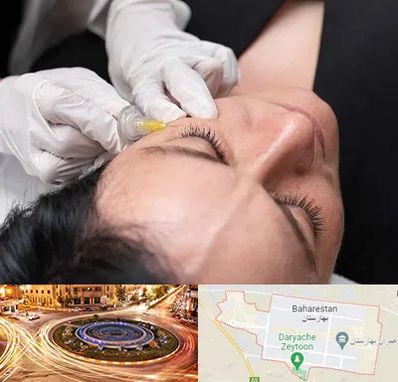 کربوکسی تراپی در بهارستان