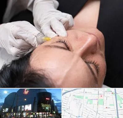 کربوکسی تراپی در بلوار اباذر