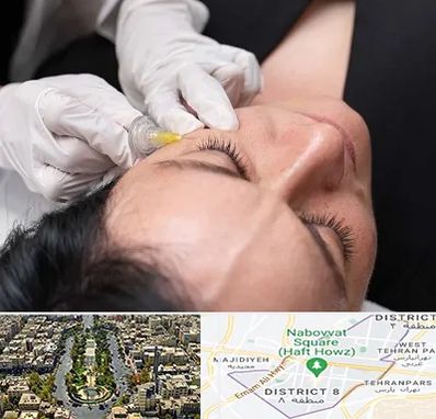 کربوکسی تراپی در نارمک 