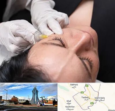 کربوکسی تراپی در تایباد