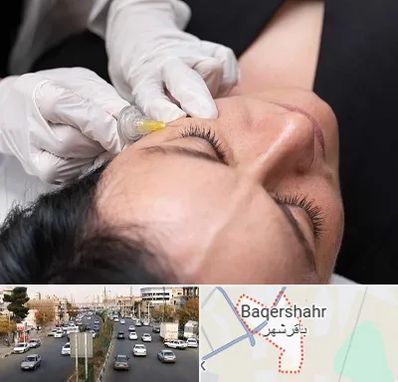 کربوکسی تراپی در باقرشهر