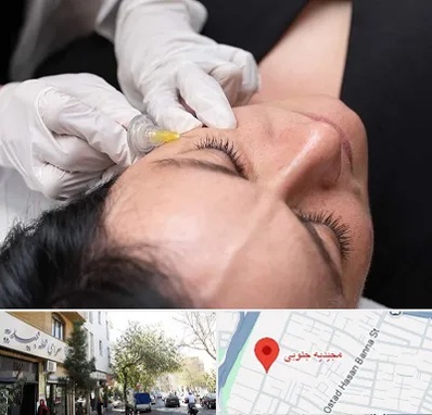 کربوکسی تراپی در مجیدیه جنوبی