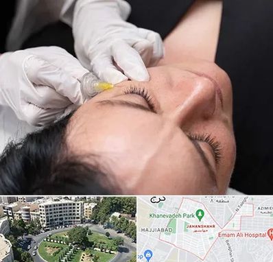 کربوکسی تراپی در جهانشهر کرج 