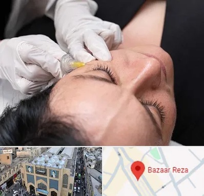 کربوکسی تراپی در بازار رضا مشهد