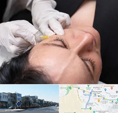 کربوکسی تراپی در شریعتی مشهد