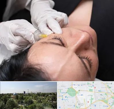 کربوکسی تراپی در منطقه 16 تهران 