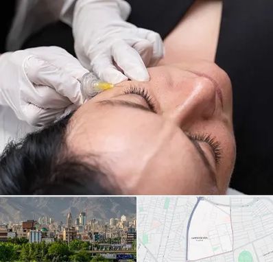 کربوکسی تراپی در جمشیدیه