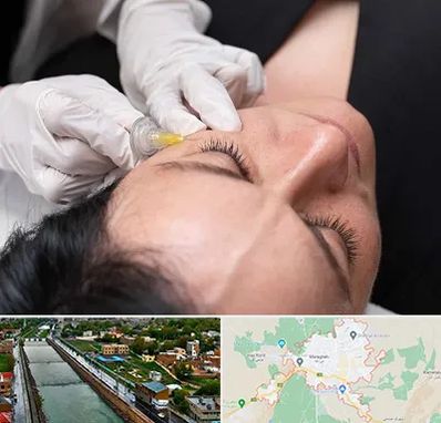 کربوکسی تراپی در مراغه