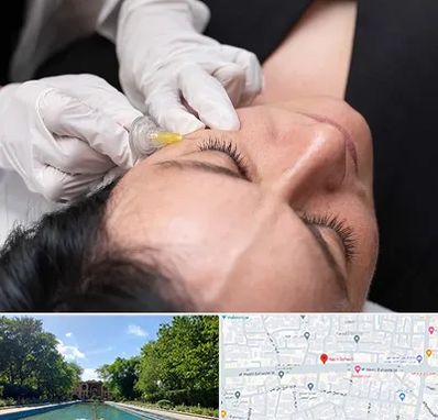 کربوکسی تراپی در هشت بهشت اصفهان