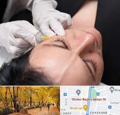 کربوکسی تراپی در چهارباغ اصفهان