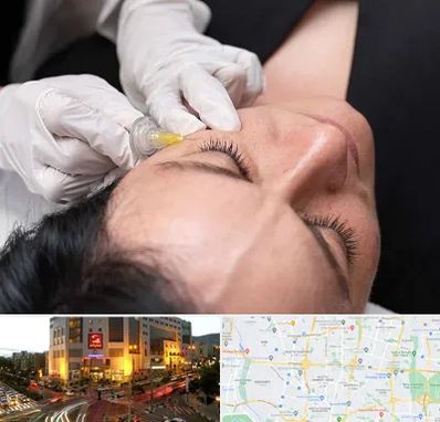 کربوکسی تراپی در جنت آباد تهران 