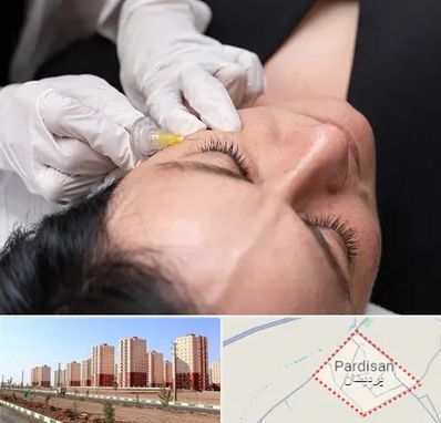 کربوکسی تراپی در پردیسان قم