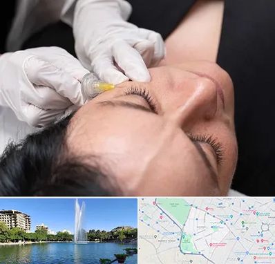 کربوکسی تراپی در کوهسنگی مشهد