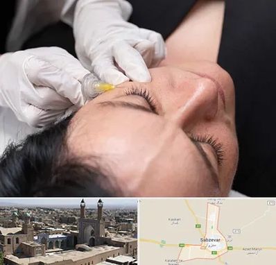 کربوکسی تراپی در سبزوار