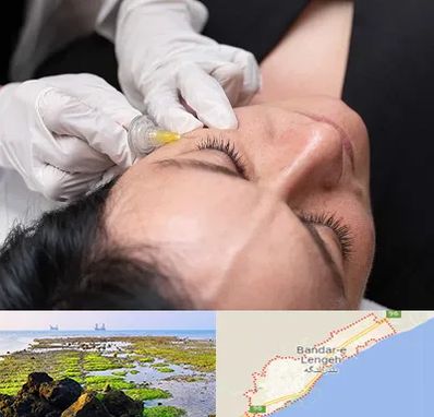 کربوکسی تراپی در بندرلنگه