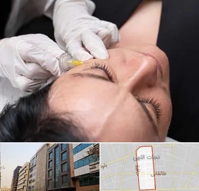 کربوکسی تراپی در نجات اللهی