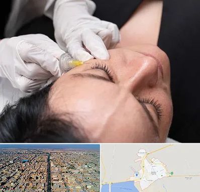 کربوکسی تراپی در بندر ماهشهر