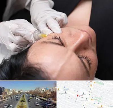 کربوکسی تراپی در بلوار معلم مشهد