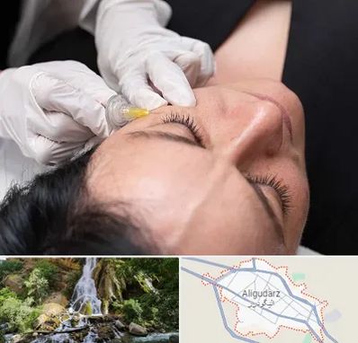 کربوکسی تراپی در الیگودرز