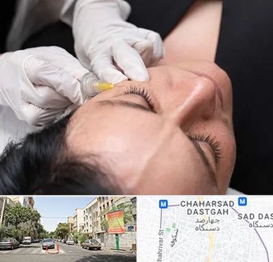 کربوکسی تراپی در چهارصد دستگاه 