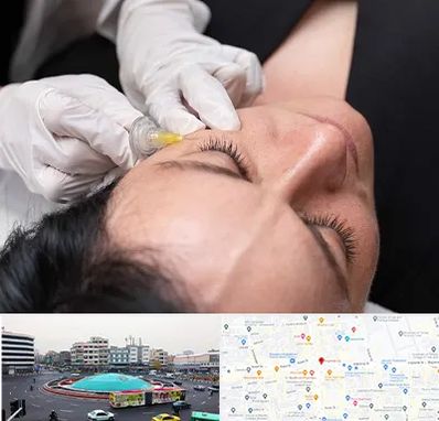 کربوکسی تراپی در میدان انقلاب 