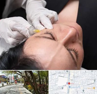 کربوکسی تراپی در خیابان توحید اصفهان