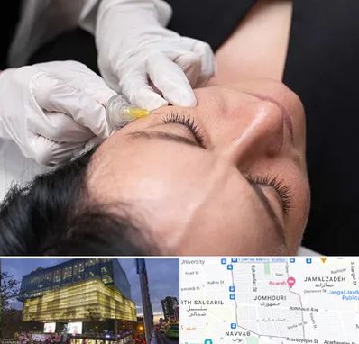 کربوکسی تراپی در جمهوری 