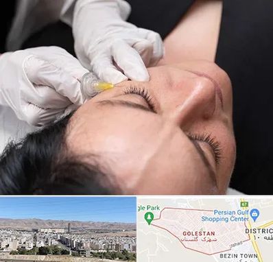 کربوکسی تراپی در شهرک گلستان شیراز