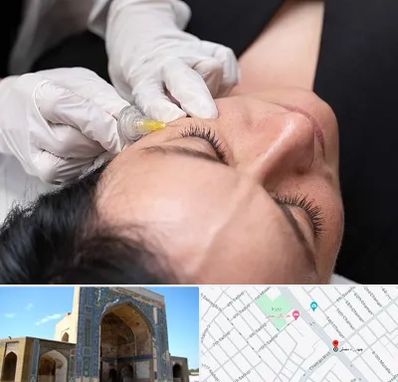 کربوکسی تراپی در مصلی مشهد