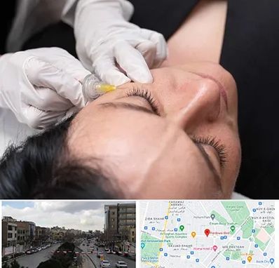 کربوکسی تراپی در بلوار فردوسی مشهد