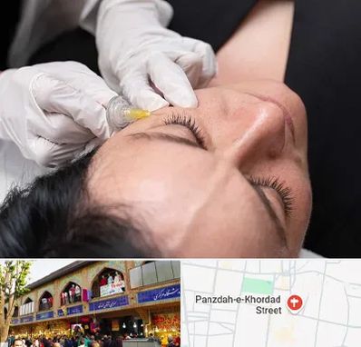 کربوکسی تراپی در 15 خرداد