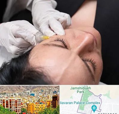 کربوکسی تراپی در نیاوران 