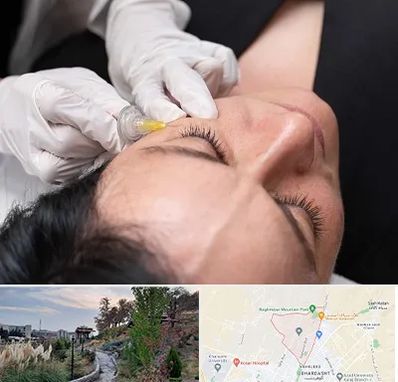 کربوکسی تراپی در باغستان کرج