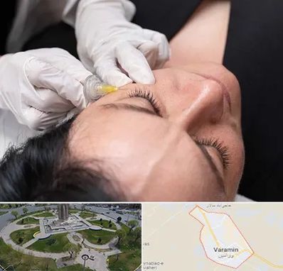 کربوکسی تراپی در ورامین