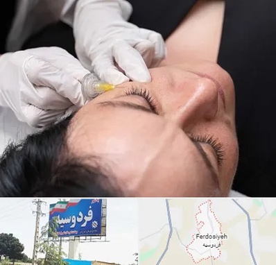 کربوکسی تراپی در فردوسیه شهریار