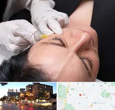 کربوکسی تراپی در بلوار سجاد مشهد 